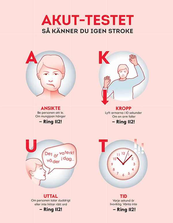 Affisch om AKUT-testet som visar hur du känner igen tecken på stroke