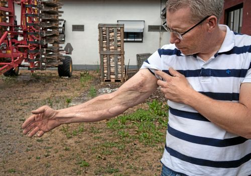 Marcus Trellman fastnade i potatisplockarmaskinen. Vägen tillbaka har varit lång.